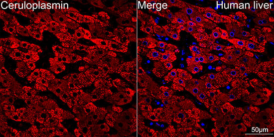 Ceruloplasmin Rabbit mAb