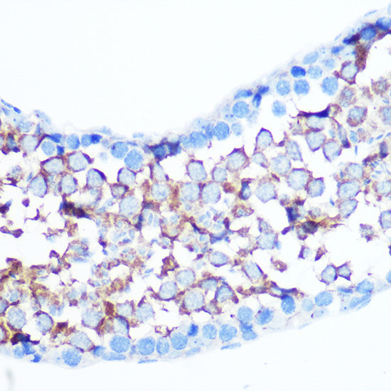 Non-phospho-YAP1-S127 Rabbit pAb