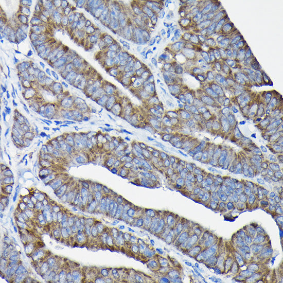 Nesprin 1 Rabbit pAb