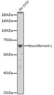 Neurofilament L Rabbit mAb