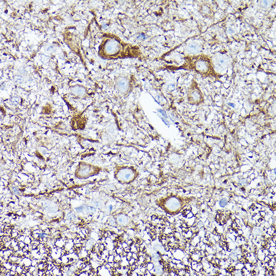 Neurofilament L Rabbit mAb