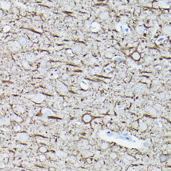 Neurofilament L Rabbit mAb