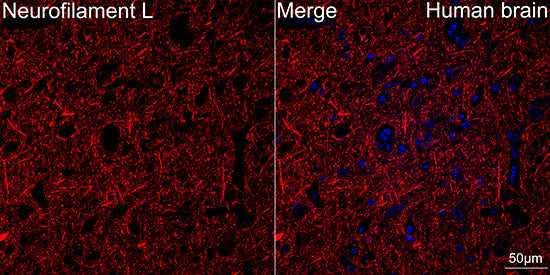 Neurofilament L Rabbit mAb