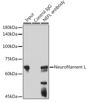 Neurofilament L Rabbit mAb