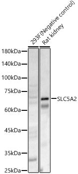 SLC5A2 Rabbit pAb