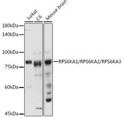 RPS6KA1/RPS6KA2/RPS6KA3 Rabbit pAb