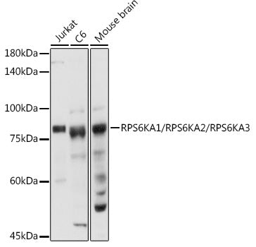 RPS6KA1/RPS6KA2/RPS6KA3 Rabbit pAb