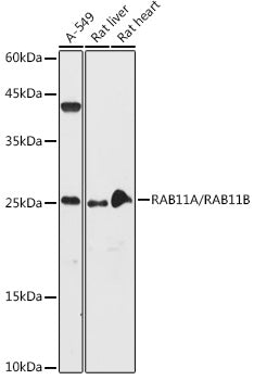 RAB11A/RAB11B Rabbit pAb