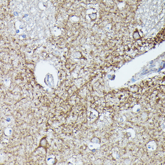 RAB11A/RAB11B Rabbit pAb