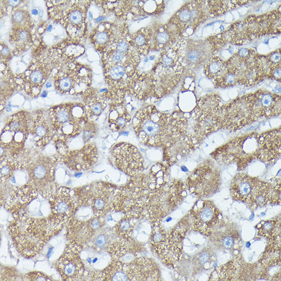 RAB11A/RAB11B Rabbit pAb