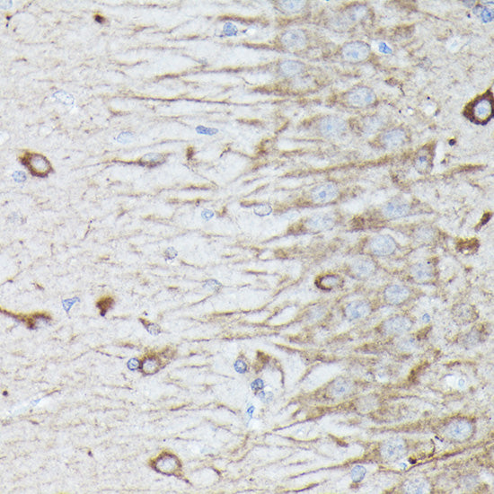 RAB11A/RAB11B Rabbit pAb