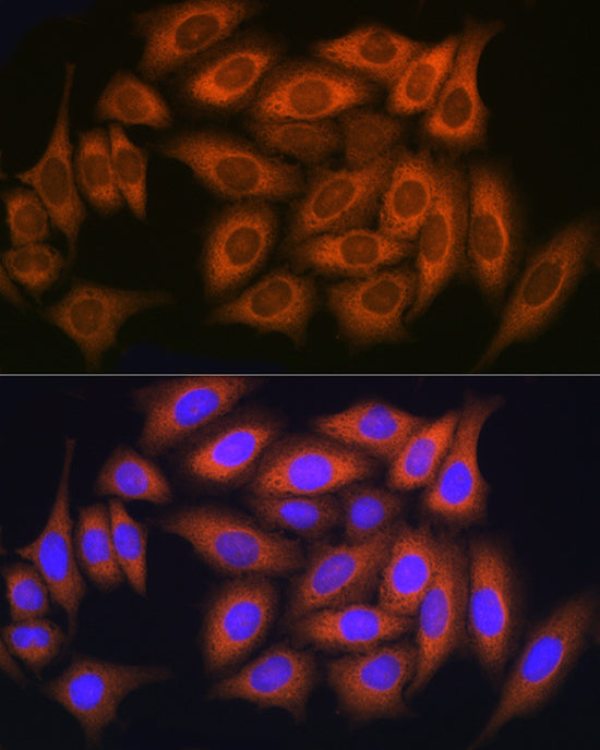 RAB11A/RAB11B Rabbit pAb