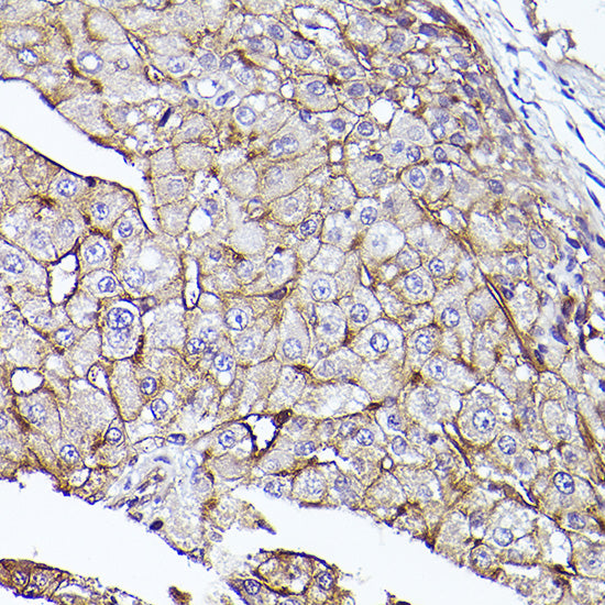 CD73/NT5E Rabbit pAb