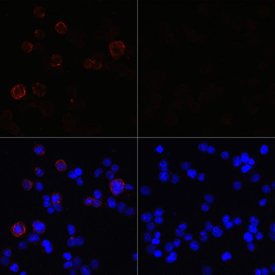 SARS-CoV-2 NSP13 Rabbit pAb