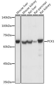 PCK1 Rabbit pAb