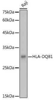 HLA-DQB1 Rabbit pAb