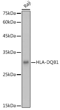 HLA-DQB1 Rabbit pAb