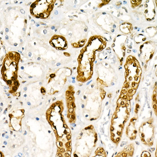 PGP9.5/UCHL1 Rabbit mAb