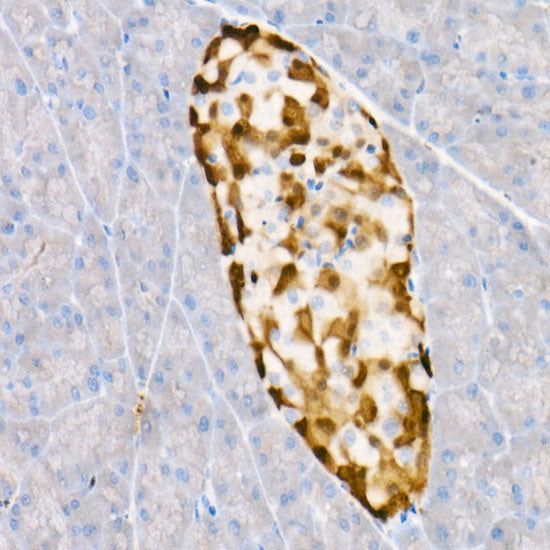PGP9.5/UCHL1 Rabbit mAb