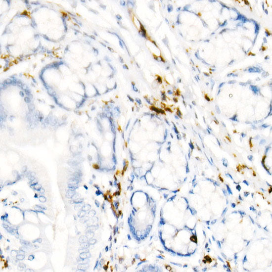 PGP9.5/UCHL1 Rabbit mAb
