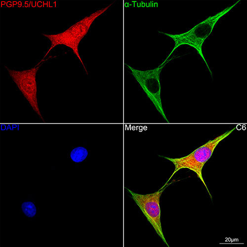 PGP9.5/UCHL1 Rabbit mAb