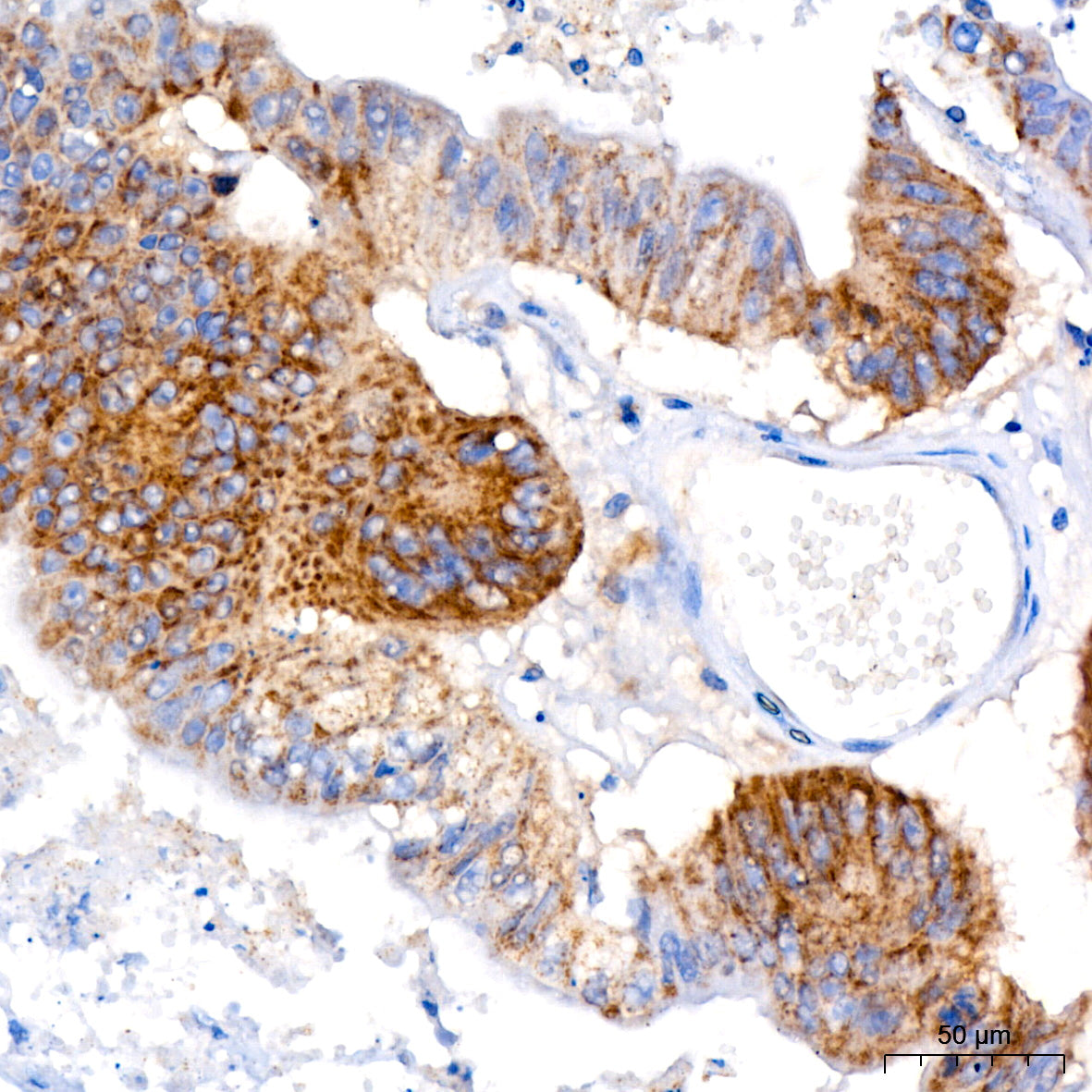 ACSL4 Rabbit mAb