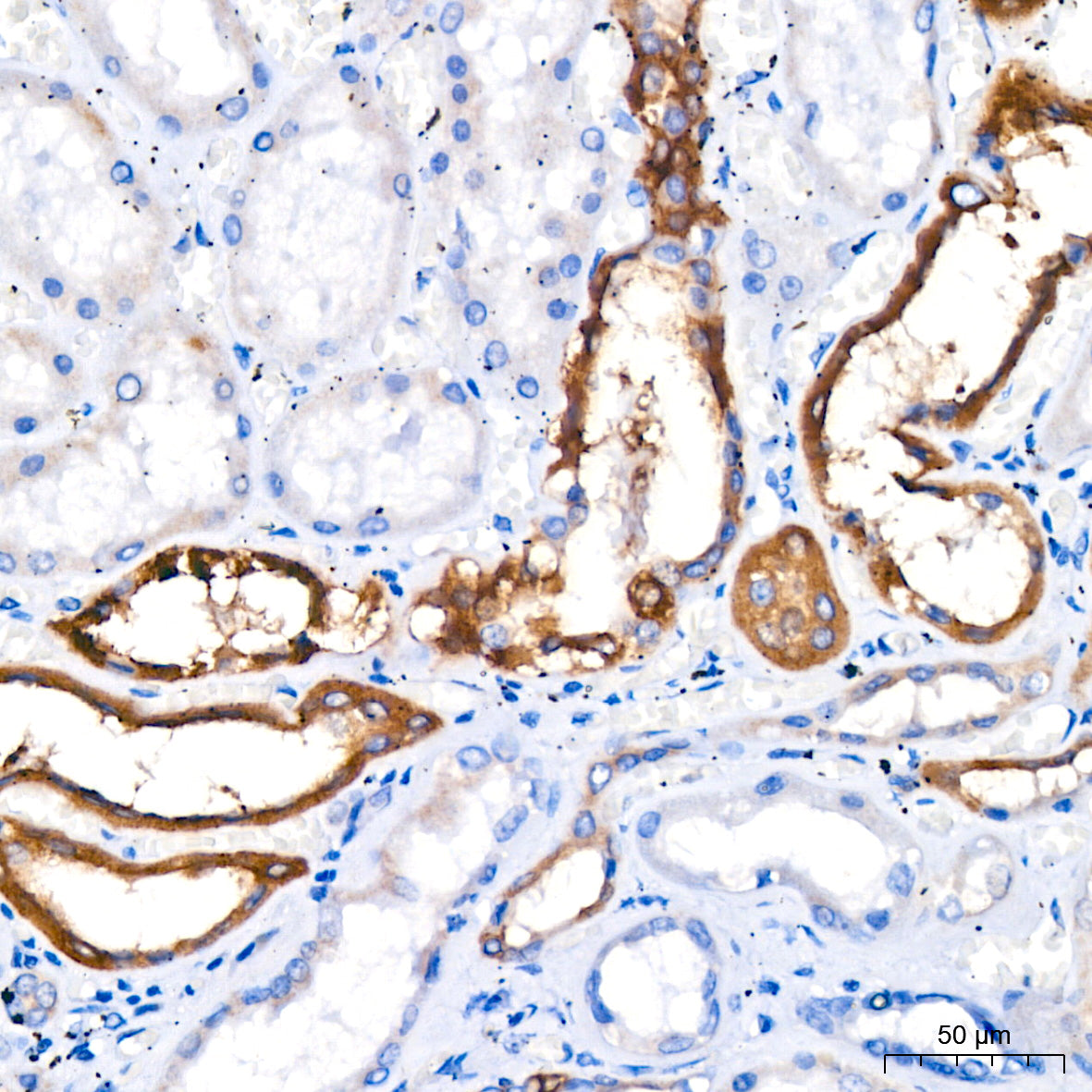 ACSL4 Rabbit mAb