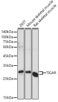 TIGAR Rabbit pAb