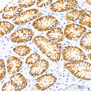 Claudin18.2 Rabbit mAb