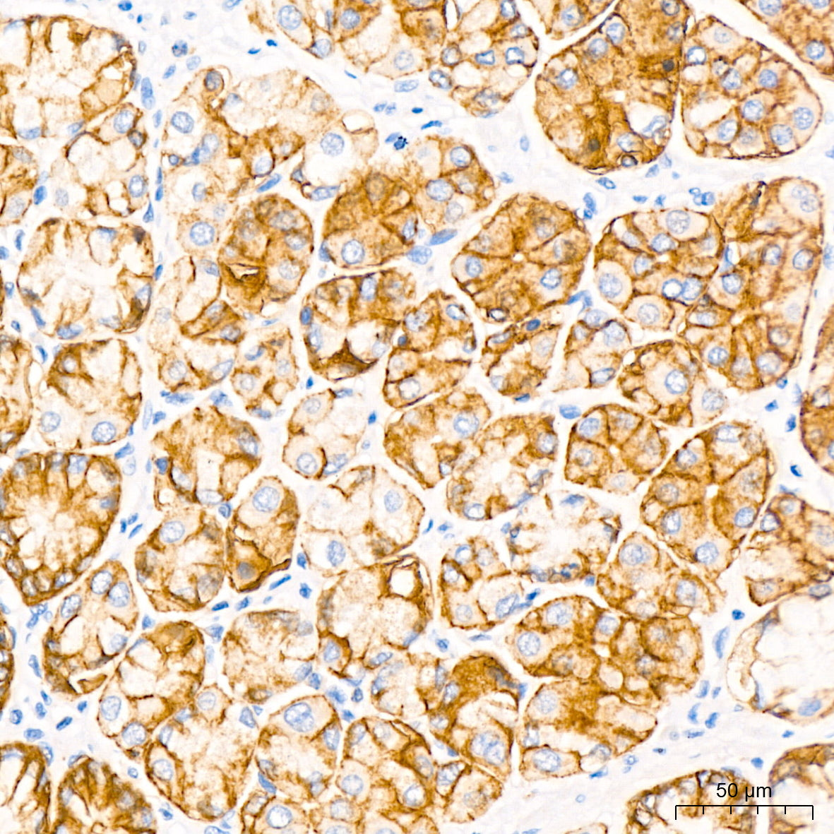 Claudin18.2 Rabbit mAb