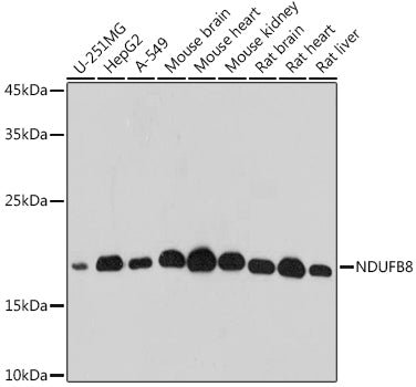 NDUFB8 Rabbit pAb