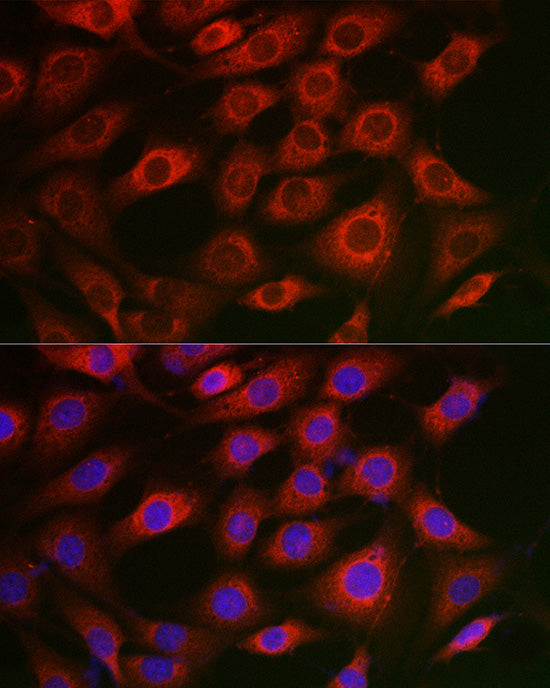 Syntrophin alpha 1 Rabbit pAb