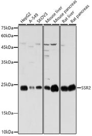 SSR2 Rabbit pAb