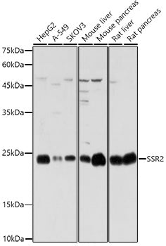 SSR2 Rabbit pAb