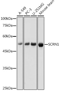 SCRN1 Rabbit pAb