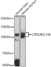 CTIP2/BCL11B Rabbit pAb