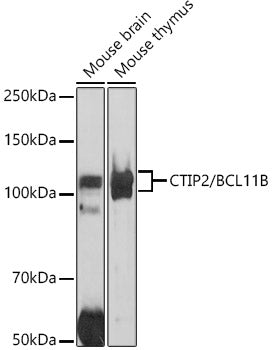 CTIP2/BCL11B Rabbit pAb