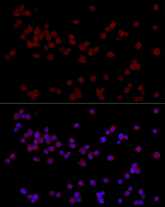 CTIP2/BCL11B Rabbit pAb