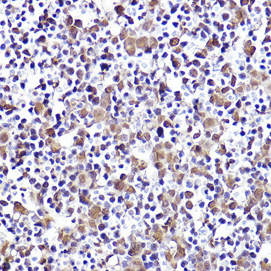 CMIP Rabbit pAb