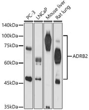 ADRB2 Rabbit pAb