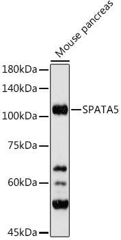 SPATA5 Rabbit pAb