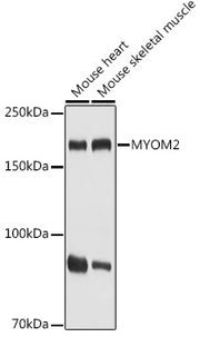 MYOM2 Rabbit pAb