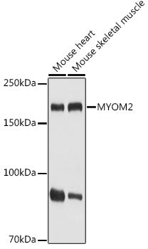 MYOM2 Rabbit pAb
