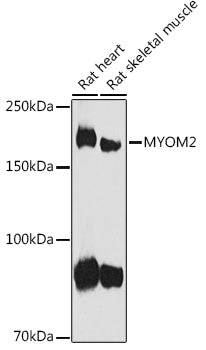MYOM2 Rabbit pAb