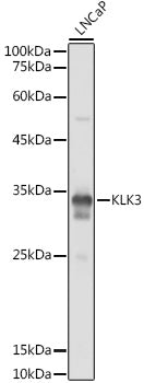 KLK3 Rabbit pAb