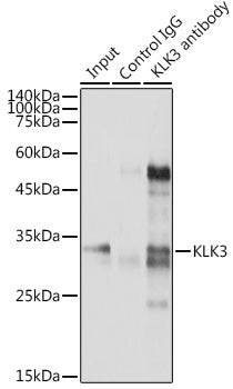 KLK3 Rabbit pAb