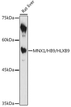 MNX1/HB9/HLXB9 Rabbit pAb