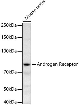 Androgen Receptor Rabbit pAb