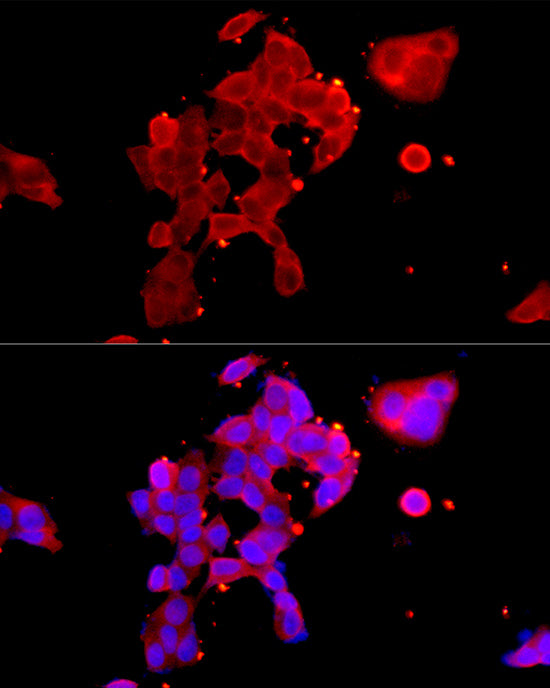 Androgen Receptor Rabbit pAb