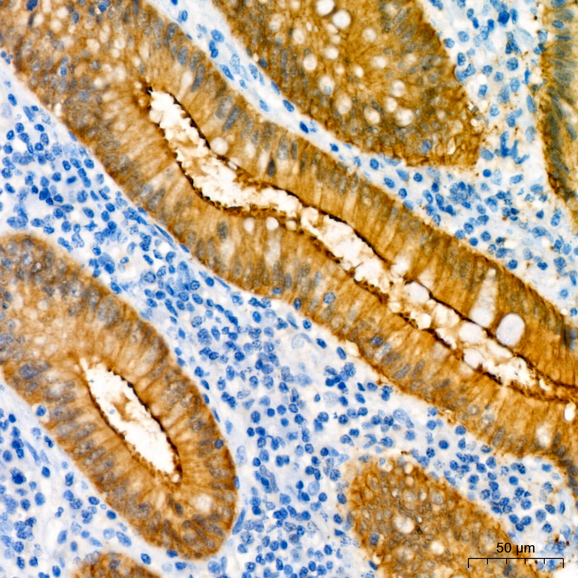 Villin1 Mouse mAb